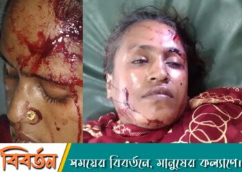 জমি নিয়ে বিরোধ:চাচাতো ভাইয়ের দায়ের কোপে জীবন-মৃত্যুর সন্ধিক্ষণে গৃহবধু খতিজা